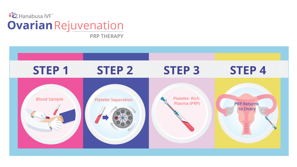 Ovarian Rejuvenation Hanabusa Ivf